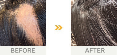 本当に思ったよりも簡単に、嘘のように元に戻りました。