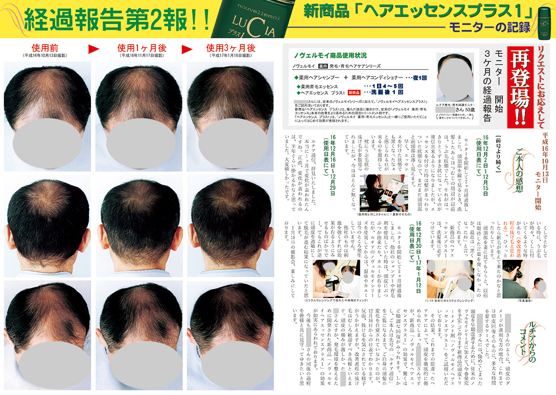 モニターの記録