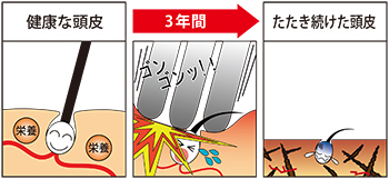 たたいた頭皮のイメージ