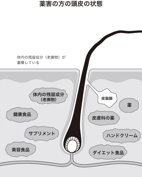 薬害の方の頭皮状態