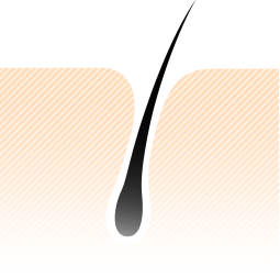 毛穴は頭皮がへこんでつくられる
