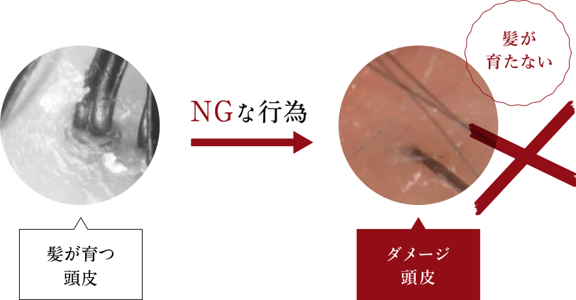 NGな行為
