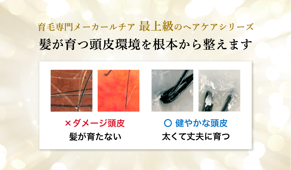 頭皮