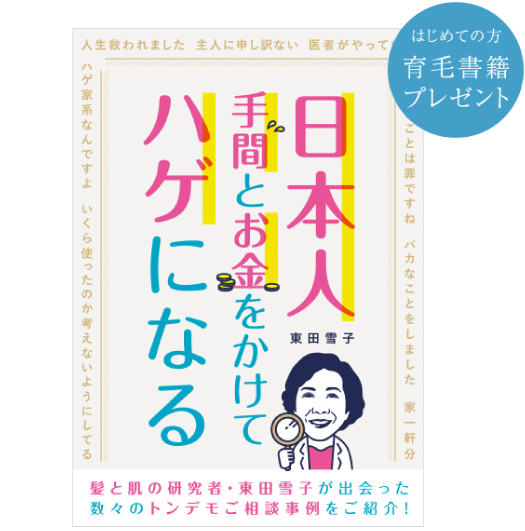 「日本人 手間とお金をかけてハゲになる」