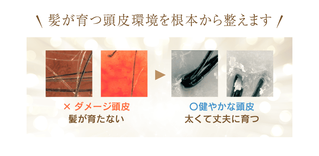 髪が育つ頭皮環境を根本から整えます