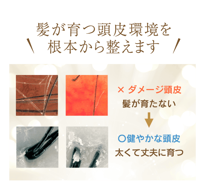 髪が育つ頭皮環境を根本から整えます