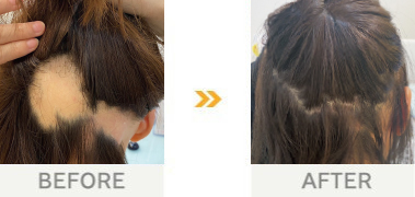 30代・女性 / 9か月