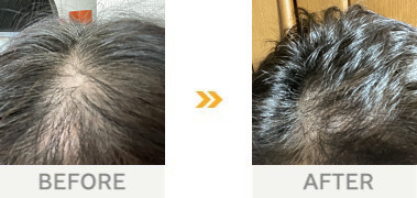 50代・女性 / 3年6か月