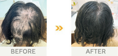 60代・女性 / 1年10か月