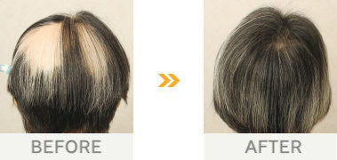 60代・女性 / 1年7か月