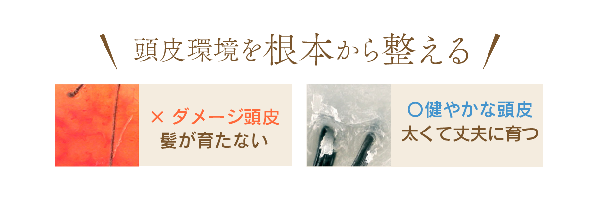 頭皮環境を根本から整える