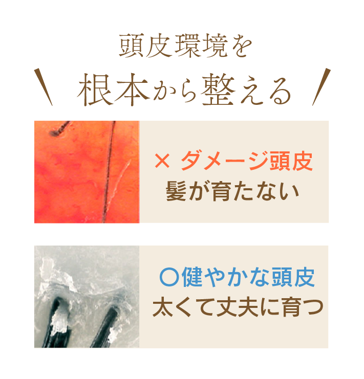 頭皮環境を根本から整える