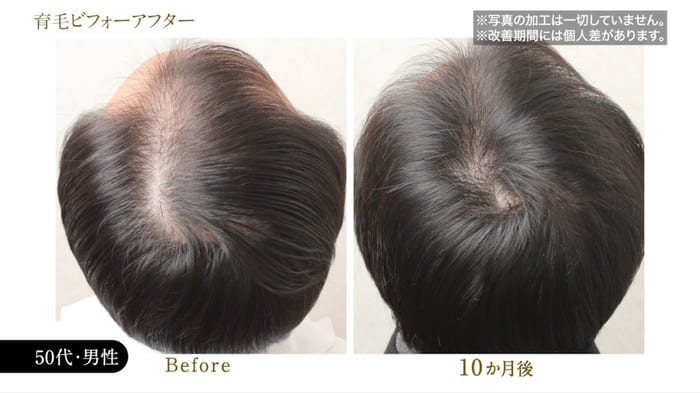 ビフォーアフター写真02