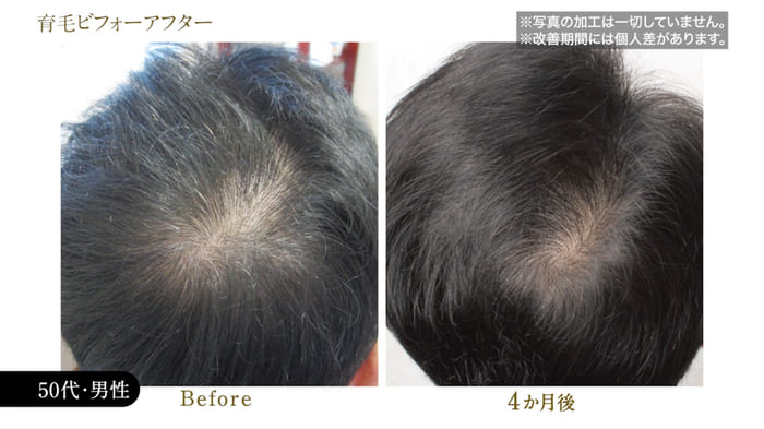 ビフォーアフター写真03
