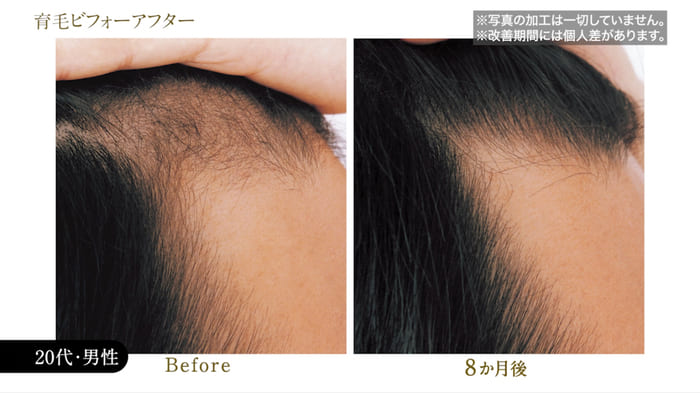 ビフォーアフター写真04