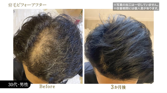 ビフォーアフター写真05