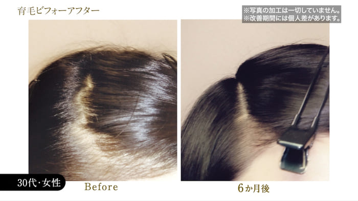 ビフォーアフター写真06