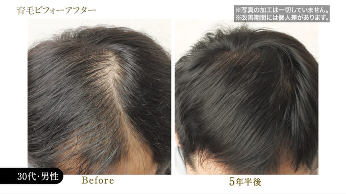 ビフォーアフター写真07