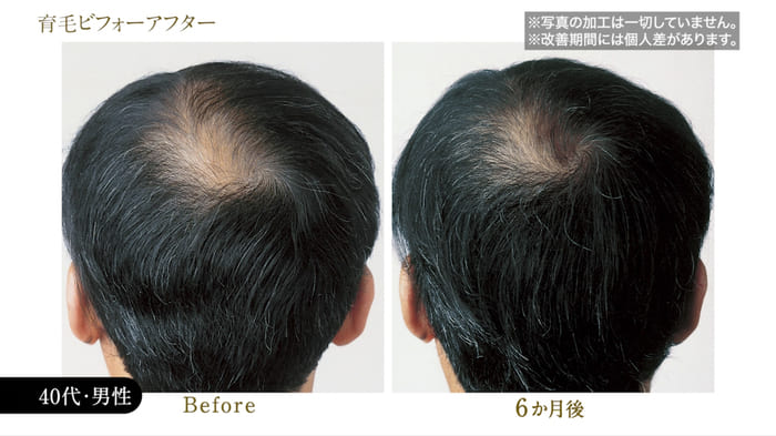ビフォーアフター写真08