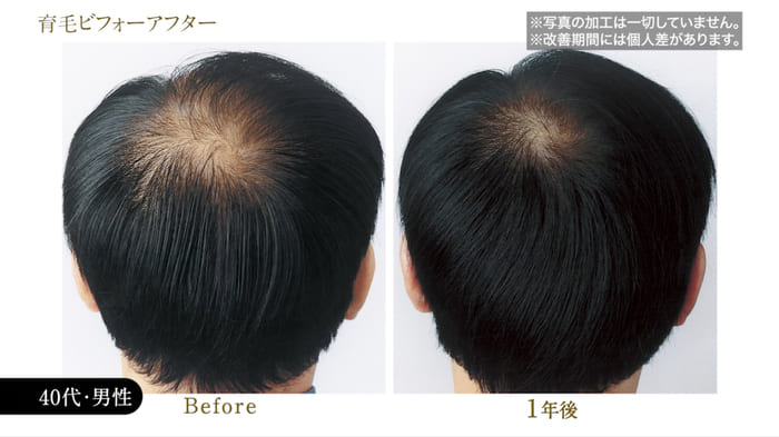 ビフォーアフター写真09