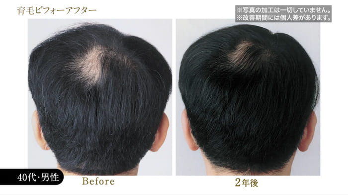 ビフォーアフター写真10
