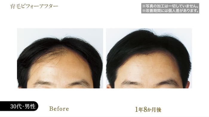 ビフォーアフター写真11