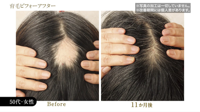 ビフォーアフター写真12