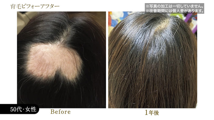 ビフォーアフター写真13