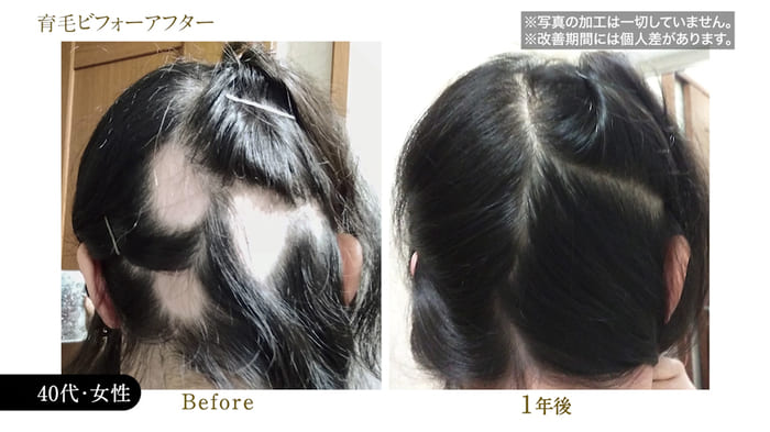 ビフォーアフター写真14
