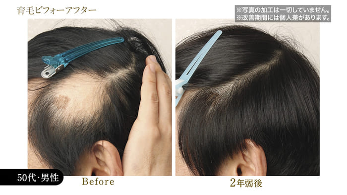 ビフォーアフター写真15