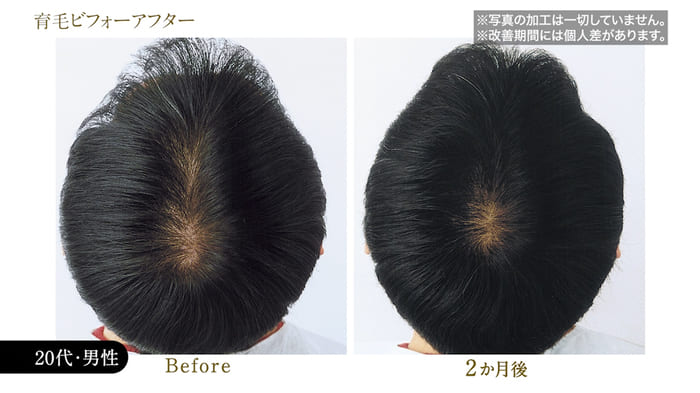 ビフォーアフター写真16
