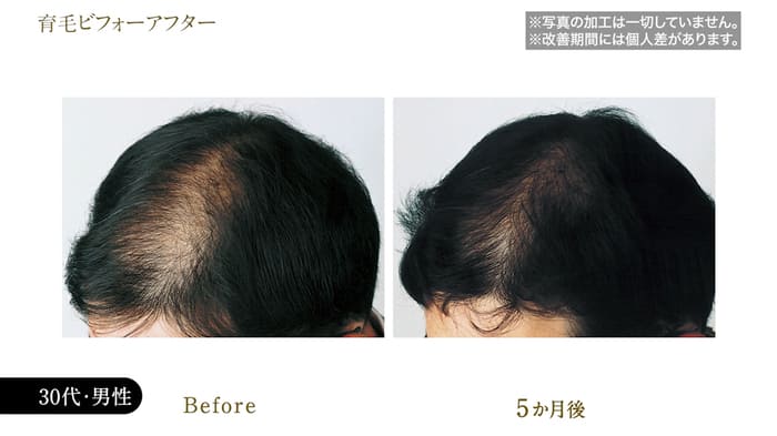 ビフォーアフター写真17