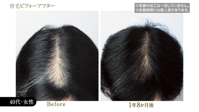 ビフォーアフター写真18