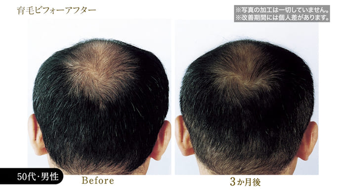 ビフォーアフター写真19