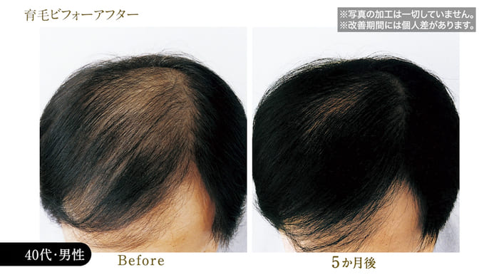 ビフォーアフター写真20
