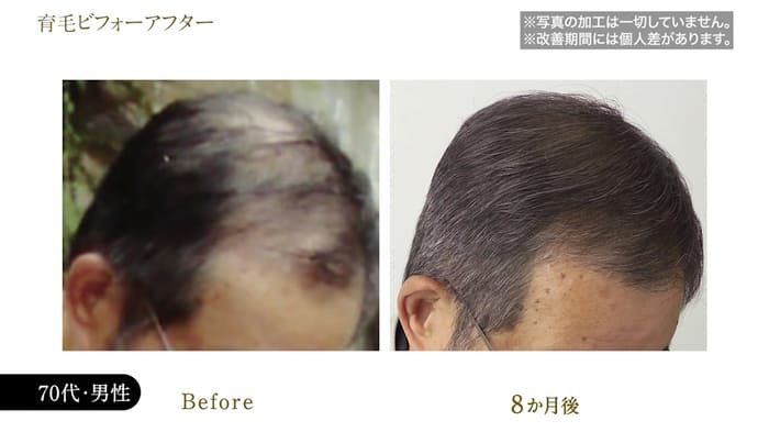 ビフォーアフター写真22