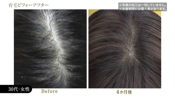 ビフォーアフター写真23