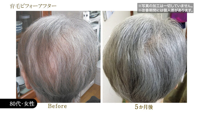 ビフォーアフター写真24