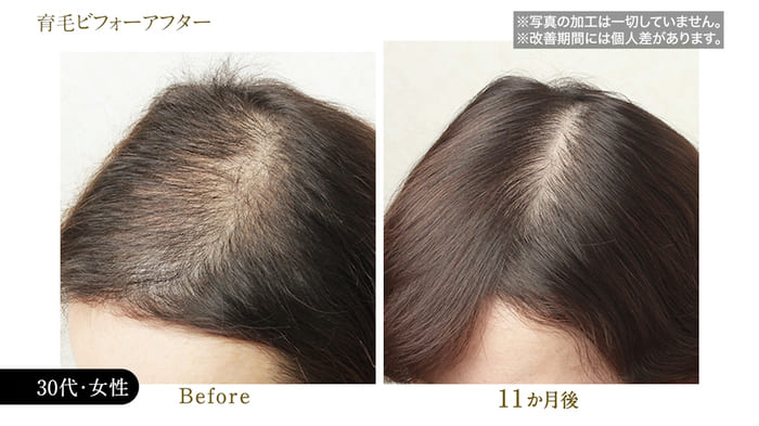 ビフォーアフター写真25