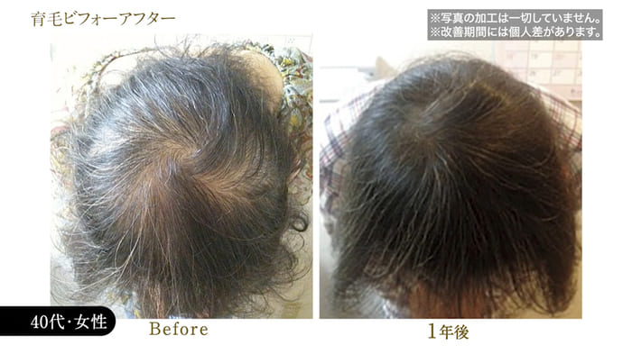 ビフォーアフター写真26