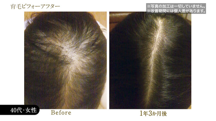 ビフォーアフター写真27