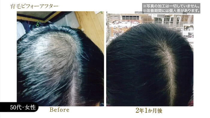 ビフォーアフター写真28
