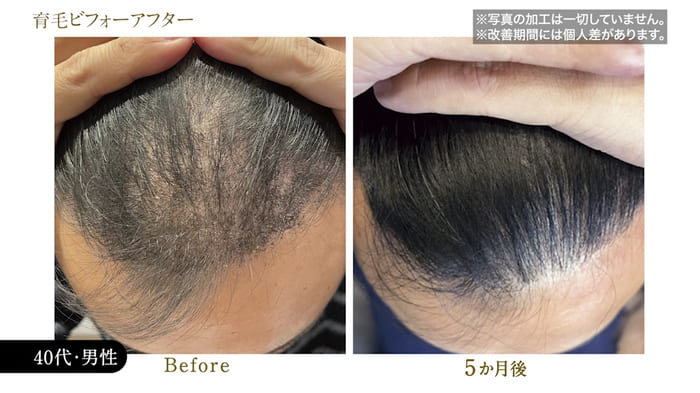 ビフォーアフター写真29